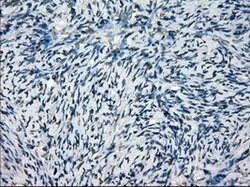 SATB1 Mouse anti-Human, Clone: OTI11H4, lyophilized, TrueMAB 100 &mu;g;