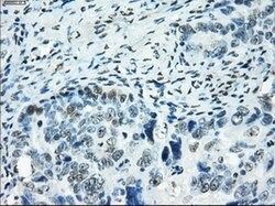 SATB1 Mouse anti-Human, Clone: OTI11H4, lyophilized, TrueMAB 100 &mu;g;