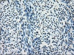 SATB1 Mouse anti-Human, Clone: OTI11H4, lyophilized, TrueMAB 100 &mu;g;