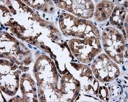 SATB1 Mouse anti-Human, Clone: OTI3E12, liquid, TrueMAB 100 &mu;L; Unconjugated:Antibodies,