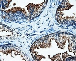SATB1 Mouse anti-Human, Clone: OTI11E8, liquid, TrueMAB 100 &mu;L; Unconjugated:Antibodies,