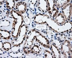 SATB1 Mouse anti-Human, Clone: OTI11E8, liquid, TrueMAB 100 &mu;L; Unconjugated:Antibodies,