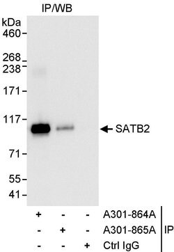 SATB2 Rabbit anti-Human, Polyclonal, Bethyl Laboratories 10 &mu;L; Unconjugated:Antibodies,