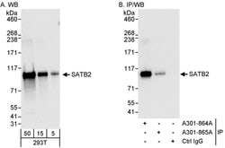 SATB2 Rabbit anti-Human, Polyclonal, Bethyl Laboratories 100 &mu;L; Unconjugated:Antibodies,