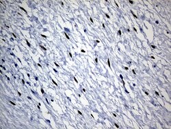 SATB2 Mouse anti-Human, Clone: OTI7E11, liquid, TrueMAB 100 &mu;L; Unconjugated:Antibodies,