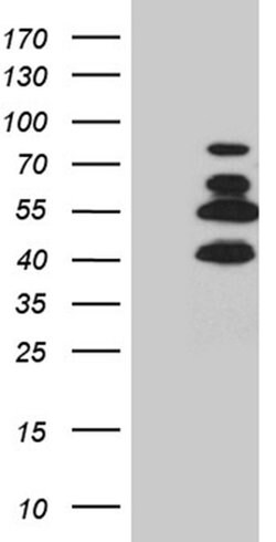 SATB2 Mouse anti-Human, Clone: OTI7E11, liquid, TrueMAB 100 &mu;L; Unconjugated:Antibodies,