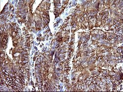 SCAMP2 Mouse anti-Human, Clone: OTI3C2, lyophilized, TrueMAB 100 &mu;g;