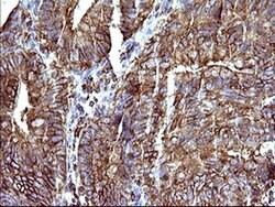 SCAMP2 Mouse anti-Human, Clone: OTI3C2, liquid, TrueMAB 100 &mu;L; Unconjugated:Antibodies,