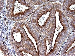 SCAMP2 Mouse anti-Human, Clone: OTI3C2, lyophilized, TrueMAB 100 &mu;g;