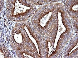 SCAMP2 Mouse anti-Human, Clone: OTI3C2, liquid, TrueMAB 100 &mu;L; Unconjugated:Antibodies,