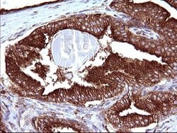 SCAMP2 Mouse anti-Human, Clone: OTI3C2, lyophilized, TrueMAB 100 &mu;g;