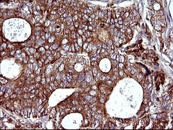 SCAMP2 Mouse anti-Human, Clone: OTI3C2, lyophilized, TrueMAB 100 &mu;g;