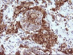 SCAMP2 Mouse anti-Human, Clone: OTI3C2, lyophilized, TrueMAB 100 &mu;g;