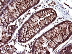 SCAMP2 Mouse anti-Human, Clone: OTI3C2, lyophilized, TrueMAB 100 &mu;g;