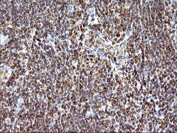 SCAMP2 Monoclonal Antibody (OTI2F1), TrueMAB , OriGene 100 &mu;L; Unconjugated:Antibodies,