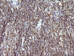 SCAMP2 Monoclonal Antibody (OTI2F1), TrueMAB , OriGene 100 &mu;L; Unconjugated:Antibodies,
