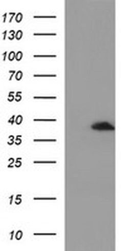 SCAMP2 Monoclonal Antibody (OTI2F3), TrueMAB , OriGene 100 &mu;L; Unconjugated:Antibodies,
