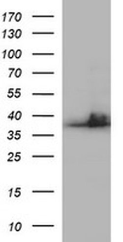 SCAMP2 Monoclonal Antibody (OTI1H7), TrueMAB , OriGene 100 &mu;L | Buy Online | OriGene | Fisher Scientific