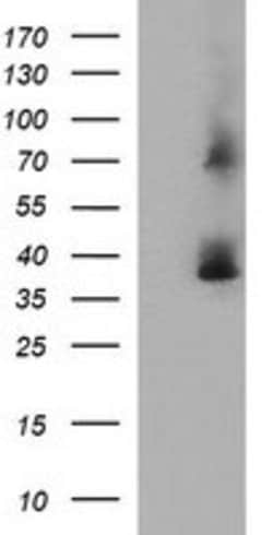 SCAMP2 Mouse anti-Human, Clone: OTI3C2, lyophilized, TrueMAB 100 &mu;g;
