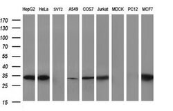 SCAMP2 Mouse anti-Human, Clone: OTI3C2, lyophilized, TrueMAB 100 &mu;g;