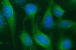 SCARB1 Monoclonal Antibody (OTI1G4), TrueMAB , OriGene 100 &mu;L; Unconjugated:Antibodies,