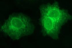 SCARB1 Monoclonal Antibody (OTI1E1), TrueMAB , OriGene 100 &mu;L; Unconjugated:Antibodies,