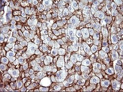 SCARB1 Mouse anti-Human, Clone: OTI1F3, lyophilized, TrueMAB 100 &mu;g | Buy Online | Origene Technologies | Fisher Scientific