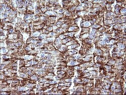 SCARB1 Mouse anti-Human, Clone: OTI1F3, lyophilized, TrueMAB 100 &mu;g | Buy Online | Origene Technologies | Fisher Scientific