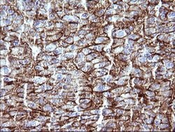 SCARB1 Mouse anti-Human, Clone: OTI1F3, liquid, TrueMAB 100 &mu;L; Unconjugated:Antibodies,