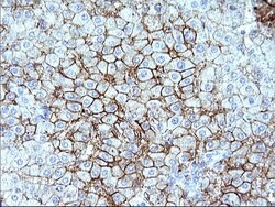 SCARB1 Monoclonal Antibody (OTI1G4), TrueMAB , OriGene 100 &mu;L; Unconjugated:Antibodies,