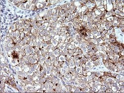 SCARB1 Monoclonal Antibody (OTI1G4), TrueMAB , OriGene 100 &mu;L; Unconjugated:Antibodies,