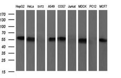 SCARB1 Mouse anti-Human, Clone: OTI1F3, lyophilized, TrueMAB 100 &mu;g | Buy Online | Origene Technologies | Fisher Scientific