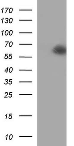 SCARB1 Monoclonal Antibody (OTI1E1), TrueMAB , OriGene 100 &mu;L; Unconjugated:Antibodies,