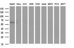 SCARB1 Monoclonal Antibody (OTI1E1), TrueMAB , OriGene 100 &mu;L; Unconjugated:Antibodies,