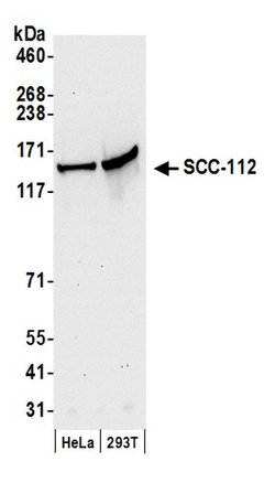 SCC-112 Polyclonal Antibody, Bethyl Laboratories 20 &mu;L; Unconjugated:Antibodies,