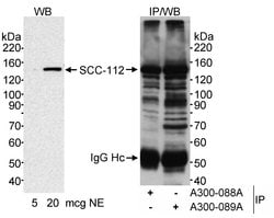 SCC-112 Rabbit anti-Human, Polyclonal, Bethyl Laboratories 100 &mu;l; Unlabeled:Antibodies,