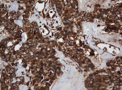 SCFD1 Monoclonal Antibody (OTI1F4), TrueMAB , OriGene 100 &mu;L; Unconjugated:Antibodies,