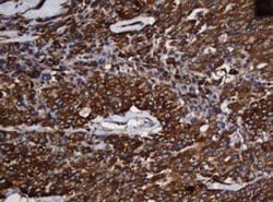 SCFD1 Monoclonal Antibody (OTI1F4), TrueMAB , OriGene 100 &mu;L; Unconjugated:Antibodies,