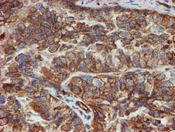 SCFD1 Monoclonal Antibody (OTI5G4), TrueMAB , OriGene 100 &mu;L; Unconjugated:Antibodies,