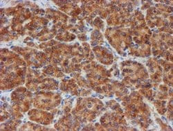 SCFD1 Monoclonal Antibody (OTI5G4), TrueMAB , OriGene 100 &mu;L; Unconjugated:Antibodies,