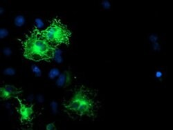 SCHIP1 Monoclonal Antibody (OTI2A11), TrueMAB , OriGene:Antibodies:Primary