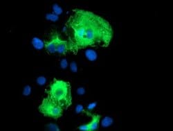 SCHIP1 Monoclonal Antibody (OTI1C8), TrueMAB , OriGene:Antibodies:Primary