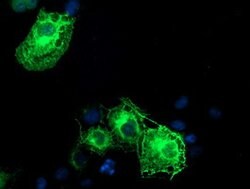 SCHIP1 Mouse anti-Human, Clone: OTI1A6, lyophilized, TrueMAB 100 &mu;g;