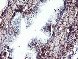 SCHIP1 Mouse anti-Human, Clone: OTI1C8, lyophilized, TrueMAB 100 &mu;g;
