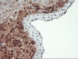SCHIP1 Mouse anti-Human, Clone: OTI1C8, lyophilized, TrueMAB 100 &mu;g;