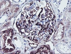 SCHIP1 Mouse anti-Human, Clone: OTI1C8, lyophilized, TrueMAB 100 &mu;g;