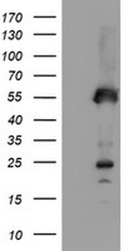 SCHIP1 Monoclonal Antibody (OTI2A11), TrueMAB , OriGene 100 &mu;L; Unconjugated:Antibodies,