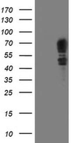 SCHIP1 Monoclonal Antibody (OTI1C8), TrueMAB , OriGene:Antibodies:Primary