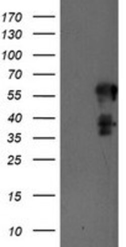 SCHIP1 Mouse anti-Human, Clone: OTI1A6, lyophilized, TrueMAB 100 &mu;g;