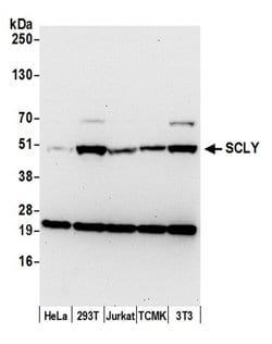 SCLY Polyclonal Antibody, Bethyl Laboratories 20 &mu;L; Unconjugated:Antibodies,